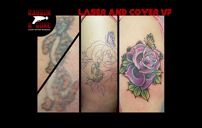 Laser Tattoo Removal Lincoln - The Tattooed Arms - Alex Stark